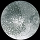 Cuticular (basal laminar) drusen - FA 2 Cuticular (basal laminar) drusen - FA 2
