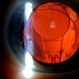 PiggyBack IOL Lens