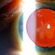 'Flower Cataract'