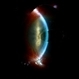 Corneal Abrasion