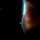Conjunctival Cyst