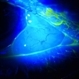 Conjunctival Cyst