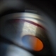 Gonioscopy, Blood in the Anterior Chamber from Hyphema