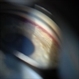 Gonioscopy, Blood in the Anterior Chamber from Hyphema