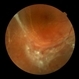 Advanced PDR