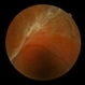 Advanced PDR