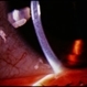 Chrysiasis