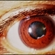 Chrysiasis