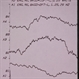 Achromatopsia / Rod monochromat