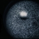 Basal Laminar Drusen / Cuticular Basal Laminar Drusen / Cuticular