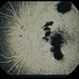 Trauma with Hemorrhages / Optic Nerve Swelling Trauma with Hemorrhages / Optic Nerve Swelling