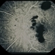 Trauma with Hemorrhages / Optic Nerve Swelling Trauma with Hemorrhages / Optic Nerve Swelling