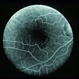 CNVM - Myopic CNVM - Myopic
