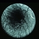 CNVM - Myopic
