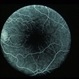 CNVM - Myopic