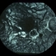 CNVM - Myopic