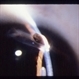 Corneal Laceration Iris In Wound