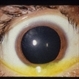 Dilated Slit Lamp Exam