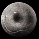 ARMD  RPE Defect / Myelinated NFL