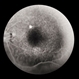 ARMD  RPE Defect / Myelinated NFL
