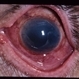 DR Rubeosis