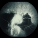 Peripapillary CNVM - ARMD Peripapillary CNVM - ARMD