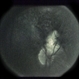Paracentral Blind Spot And Scotoma