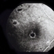 Decreased Visual Acuity (Case 2)