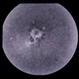 ARMD Laser Rx