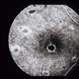 Decreased Visual Acuity (Case 2)