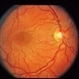 Normal Retina