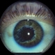 Retinal Vascular Occlusive Disease