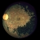 Bull's Eye Maculopathy / Chloroquine