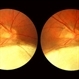 Coloboma, In Stereo Coloboma, In Stereo