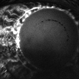 Iris Neovascularization in Endogenous Endophthalmitis Iris Neovascularization in Endogenous Endophthalmitis