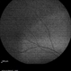 Autofluorescence 10-14-13 AZOOR Autofluorescence 10-14-13 AZOOR