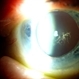 Polychromatic Cataract (Christmas Tree Cataract)