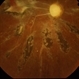 Optic Atrophy With Pigmented Epithellium Optic Atrophy With Pigmented Epithellium