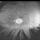 Retinitis Pigmentosa and Macular Hole Retinitis Pigmentosa and Macular Hole