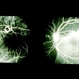 Massive Vitreous Hemorrhage 2 Massive Vitreous Hemorrhage 2