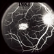 Stargardt's Dystrophy
