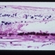RPE Hypertrophy