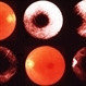 Inflammation Inflammation