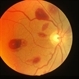 Roth Spots Roth Spots