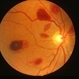 Roth Spots Roth Spots