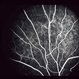 Normal Retina