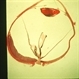 Melanoma Melanoma