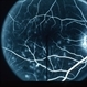 FA Fleck Retinopathy With Dark Choroid Stargardt FA Fleck Retinopathy With Dark Choroid Stargardt