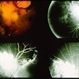 Subretinal Hemorrhage 5 Subretinal Hemorrhage 5
