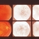 Inflammation Inflammation